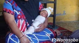 Bayi asal Desa Jolontoro, Kecamatan Sapuran, Kabupaten Wonosobo yang diberi nama 'MBG'.